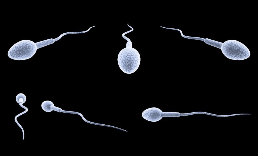 Male Infertility