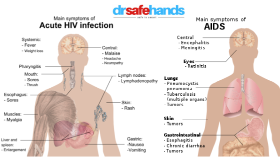 symptoms of HIV & AIDS
