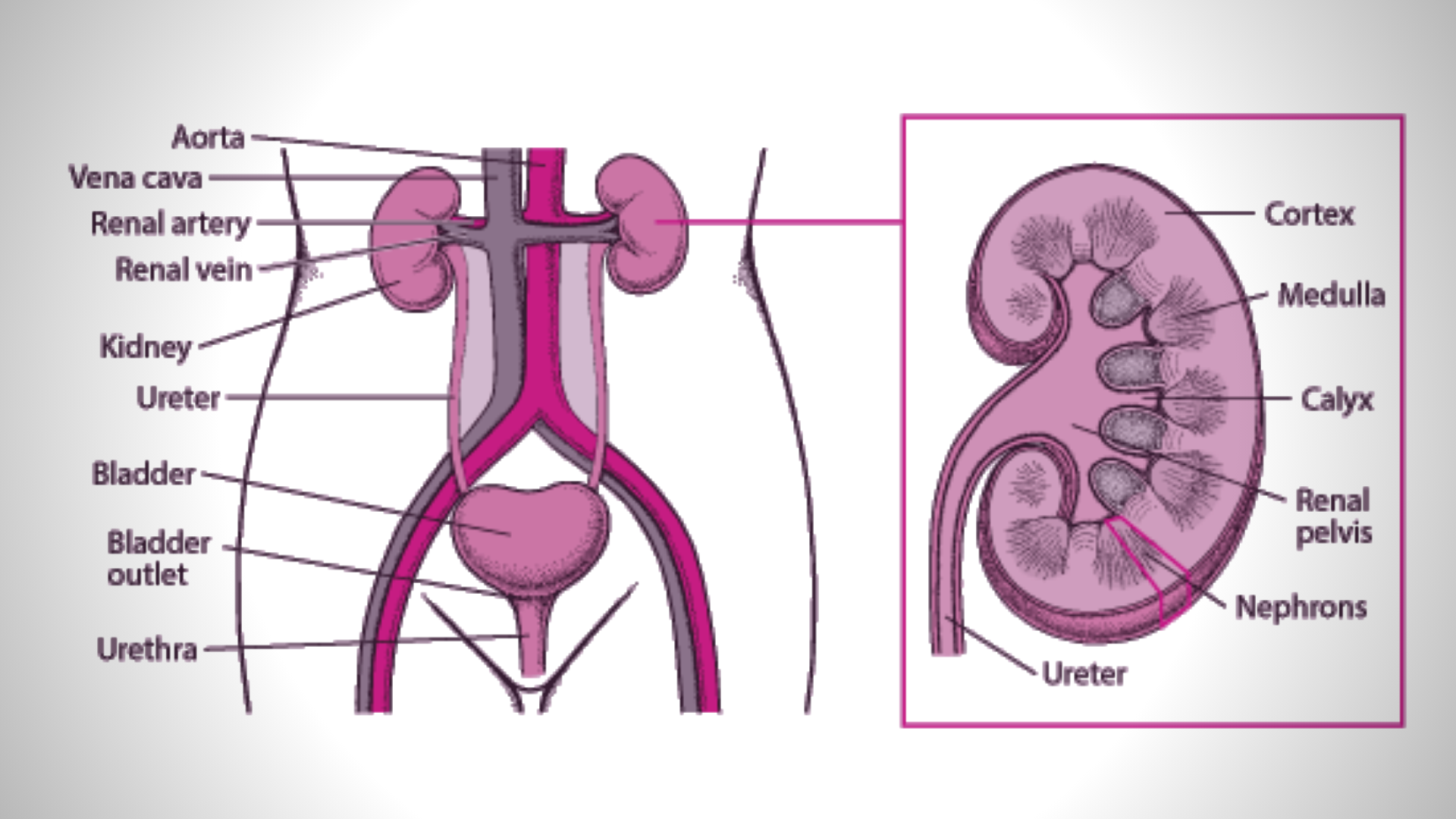 What is Urinary Tract Infection