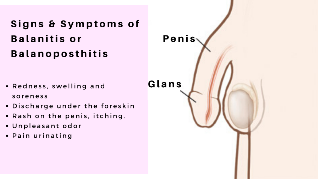 Balanitis Causes Symptoms Treatments Complications