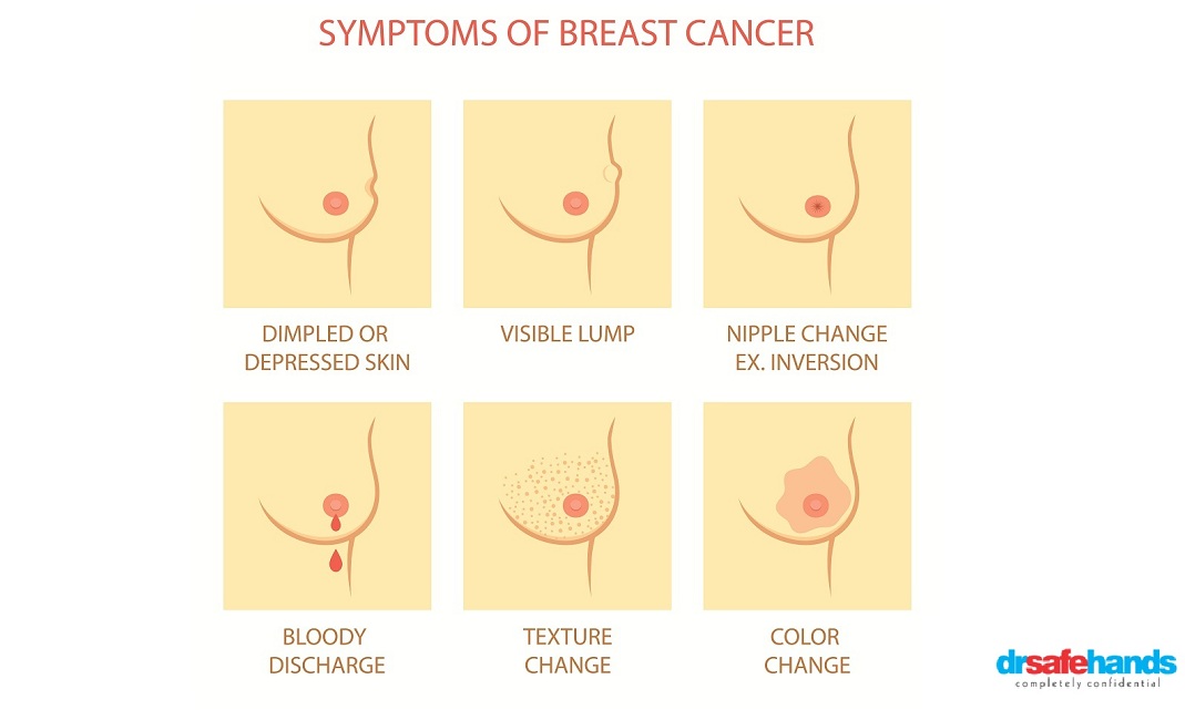 symptoms of breast cancer