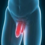 Signs and symptoms of penile cancer
