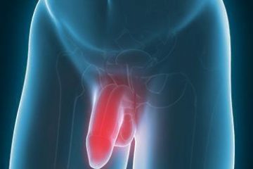 Signs and symptoms of penile cancer
