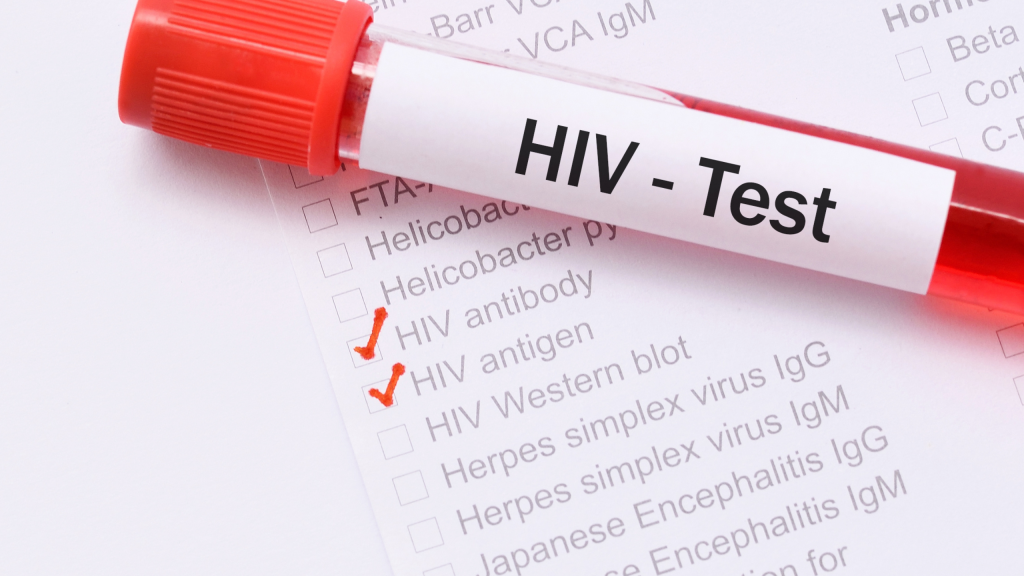hiv blood test