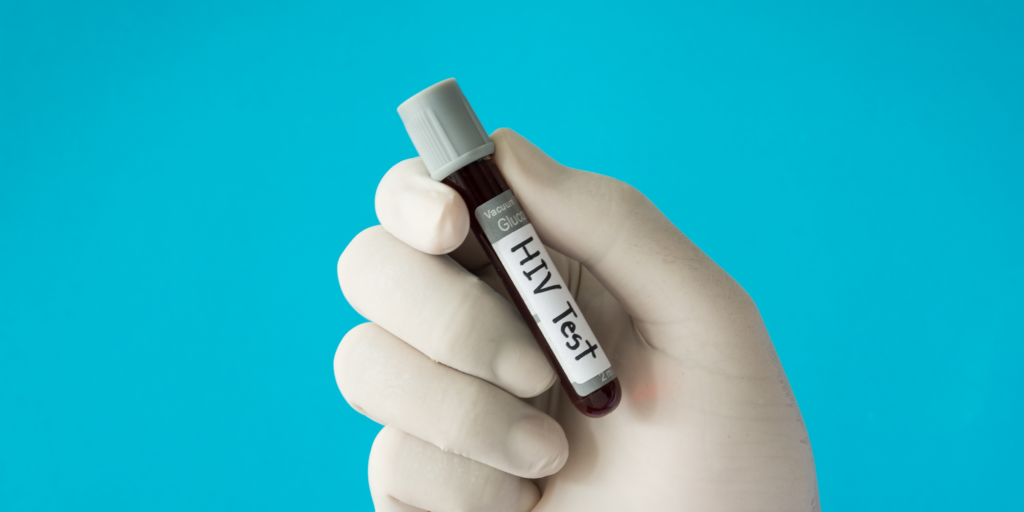 viral load hiv test