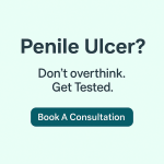 Treatment Options for Penile Ulcers